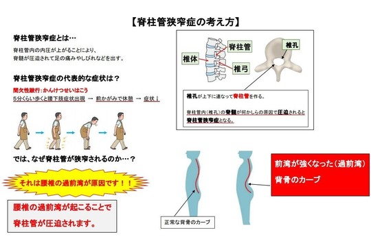 AKS療法®自主勉強会in広島(第2回) - 名古屋市西区の椎間板 AKS療法®自主勉強会in広島(第2回) - 名古屋市西区の椎間板